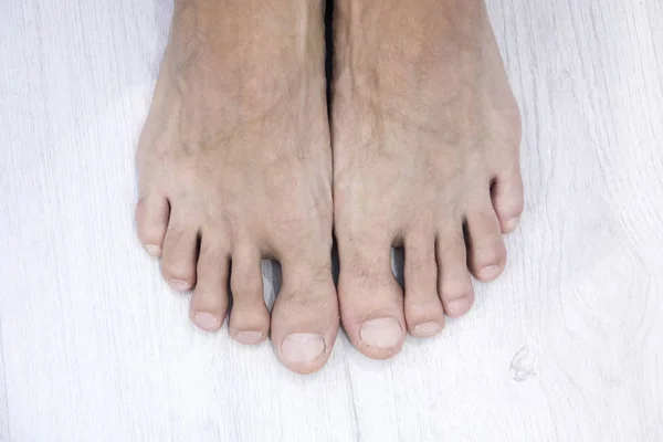 Bovenaanzicht van mannelijke nagel en voeten op witte achtergrond, dit heeft een uitknippad — Stockfoto