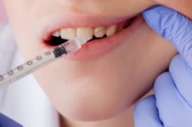 İğneler, şırınga, diş hekimi ziyaret sandalyede siting portre portre dehşete kız kadın korktuğu, açılan ağız diş prosedür delme diş çekimi istemiyor