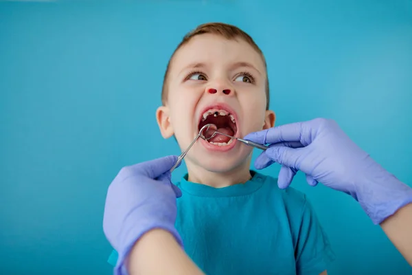 Close up of dentist\'s hands with assistant in blue gloves are treating teeth to a child, patient\'s face is closed