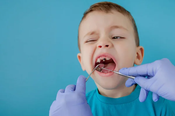 Dentista esaminando i denti del ragazzo su sfondo blu. Un piccolo paziente sulla sedia dentaria sorride. Dantista tratta i denti. vista da vicino del dentista che tratta i denti del bambino nello studio del dentista . — Foto Stock