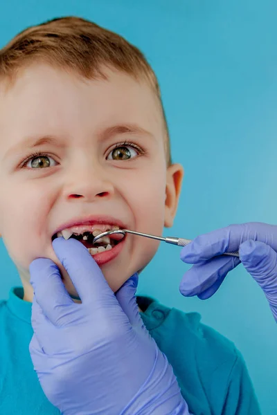 Piccolo paziente non vuole aprire la bocca del dentista su sfondo blu. Dantista tratta i denti. vista da vicino del dentista che tratta i denti del bambino nello studio del dentista. — Foto Stock