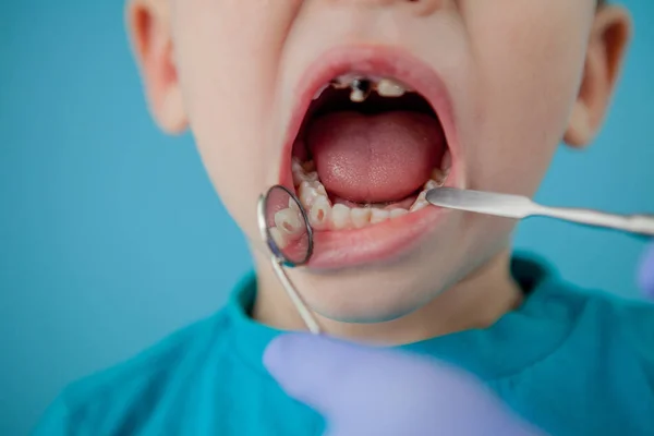 Dentista esaminando i denti del ragazzo su sfondo blu. Un piccolo paziente sulla sedia dentaria sorride. Dantista tratta i denti. vista da vicino del dentista che tratta i denti del bambino nello studio del dentista . — Foto Stock