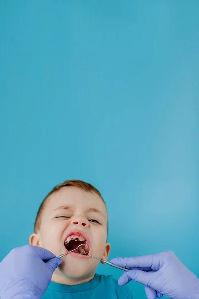 Primo piano dei dentisti mani con assistente in guanti blu stanno trattando i denti a un bambino, il volto dei pazienti è chiuso — Foto Stock