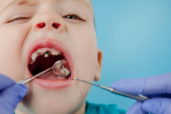 Dentista esaminando i denti del ragazzo su sfondo blu. Un piccolo paziente sulla sedia dentaria sorride. Dantista tratta i denti. vista da vicino del dentista che tratta i denti del bambino nello studio del dentista . — Foto Stock