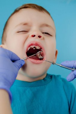 Mavi eldivenli asistanla dişçi ellerini kapatıyorlar. Çocuğa diş tedavisi uyguluyorlar. Hastanın yüzü kapalı..