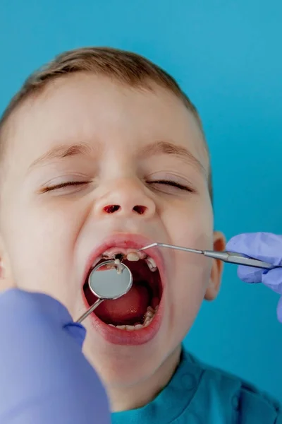 Mavi Eldivenli Asistanla Dişçi Ellerini Kapatıyorlar Çocuğa Diş Tedavisi Uyguluyorlar — Stok fotoğraf