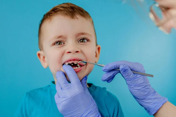 Piccolo Paziente Non Vuole Aprire Bocca Del Dentista Sfondo Blu — Foto Stock