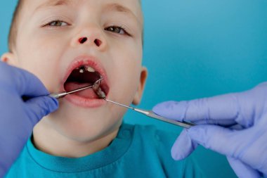 Mavi eldivenli asistanla dişçi ellerini kapatıyorlar. Çocuğa diş tedavisi uyguluyorlar. Hastanın yüzü kapalı..