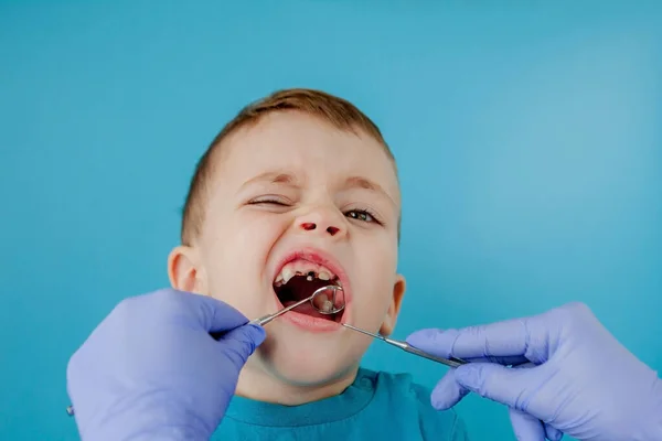 Primo Piano Delle Mani Del Dentista Con Assistente Guanti Blu — Foto Stock