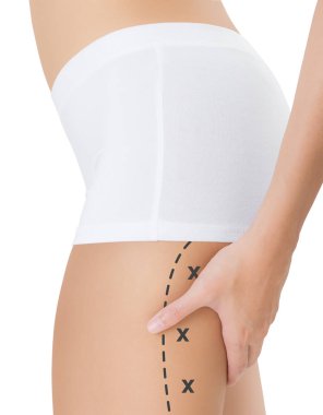 İşaretleme, kaybetmek ağırlık ve liposuction selülit kaldırma kavramı, göl kenarında beyaz arka planda siyah renk ile arka uyluk sıkma kadın haçlar.