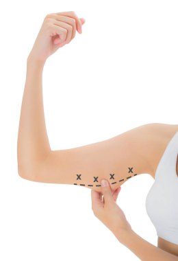 işaretleme, kaybetmek ağırlık ve liposuction selülit kaldırma kavramı, göl kenarında beyaz arka planda siyah renk ile üst kolu ciltte kapma kadın haçlar.