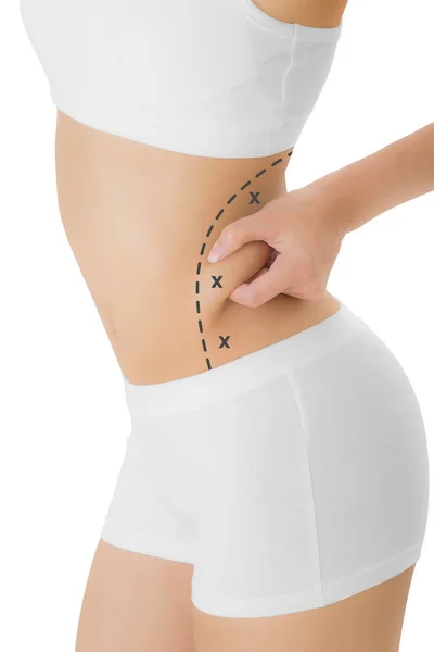 Femme attrapant la peau sur sa hanche avec la couleur noire croix marquage, Perdre du poids et concept d'élimination de la cellulite liposuccion, Isolé sur fond blanc . — Photo