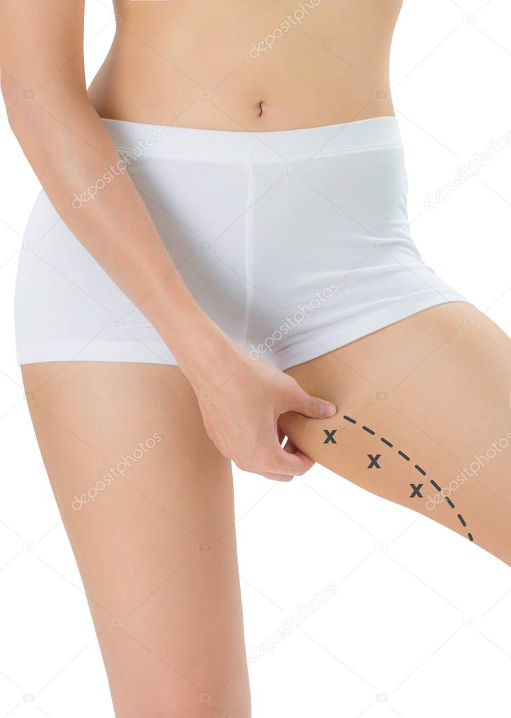 Woman grabbing skin on her Inner thigh with the black color crosses marking, Lose weight and liposuction cellulite removal concept, Isolated on white background.
