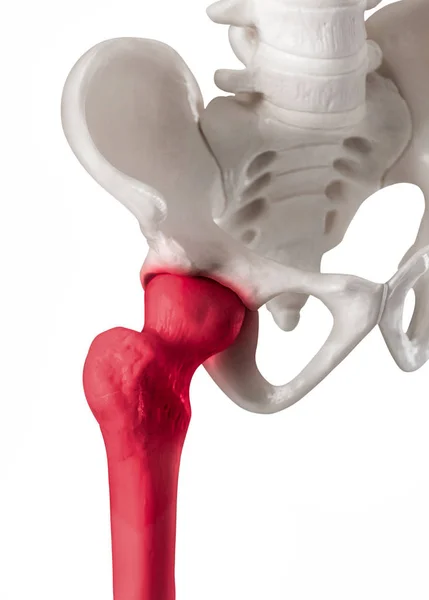 Articulação do quadril humano com destaque vermelho na região de dor óssea do fêmur ou coxa-Cuidados de saúde-anatomia humana e conceito médico isolado em fundo branco . — Fotografia de Stock
