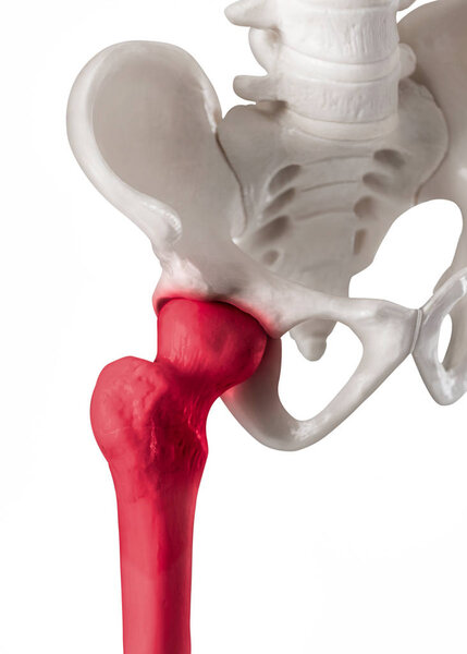 Human hip joint with red highlight on Femur or Thigh bone pain area-Healthcare-Human Anatomy and Medical concept-Isolated on white background.