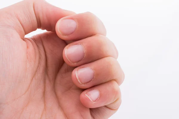 Hand, fingers and fingernails on a white background — Stock Photo, Image