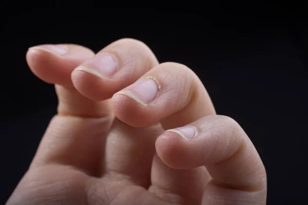 Cuatro Dedos Una Mano Infantil Parcialmente Vistos Fondo Negro —  Fotos de Stock