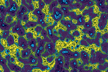 Şimşek, radyasyon gaz arkaplan dokusunu bozuyor