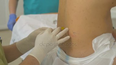 Tanınmayan doktor iğne omurga ti içinde yapıyor. Spinal anestezi.