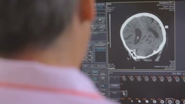 Tanınmayan doktor bir kafa Mr'ı inceden inceye gözden geçirmek bilgisayar ekranında inceliyor.