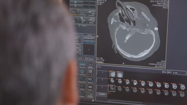 El médico irreconocible examina una resonancia magnética en la cabeza en la pantalla de una computadora . — Vídeos de Stock