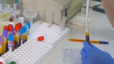 Kadın bilim adamı test tüpleri, pipet ve laboratuvar test kan örnekleri ile çalışma.