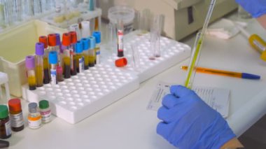Kadın bilim adamı test tüpleri, pipet ve laboratuvar test kan örnekleri ile çalışma.