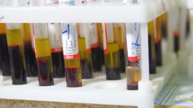 Şişeleri kan örnekleri.