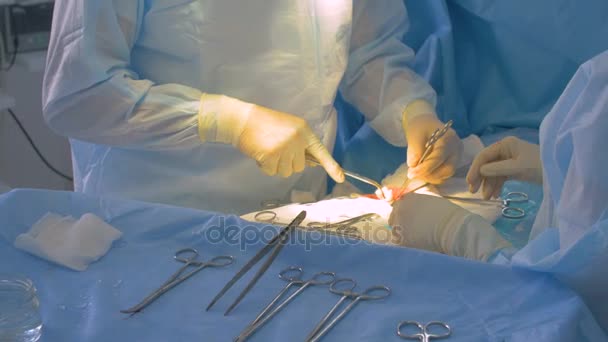 Mãos a usar luvas cirúrgicas a fazer cirurgia. Fechar . — Vídeo de Stock