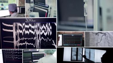 Gerçek kalp ameliyatı. Monitörleri kontrol odasında. Cerrah manipülasyonlar bir hastayla bir operasyon odasında yapar..