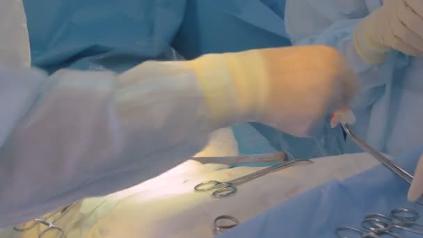 Surgeons operating with surgical instruments. — Stock Video