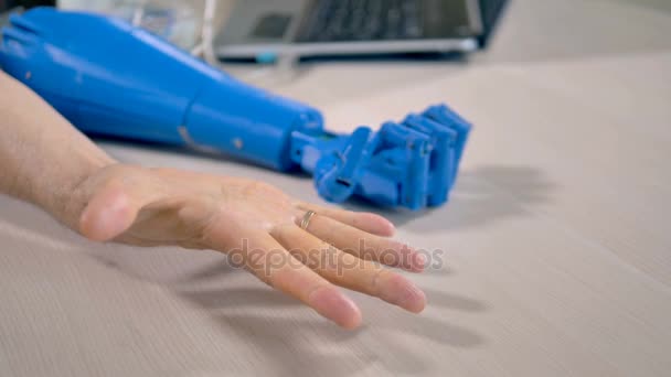 A human arm clenches a tight fist to test a bionic hand. — Stock Video