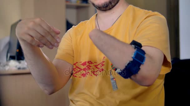 残疾的男子与仿生传感器用于计算机控制的截肢手。4 k. — 图库视频影像