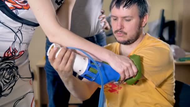 Fixation d'un membre artificiel sur la main amputée . — Video