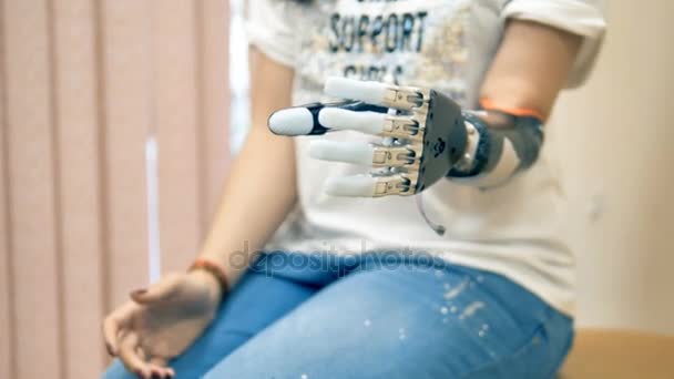 Een geamputeerde vrouw toont haar bionic hand. 4k. — Stockvideo