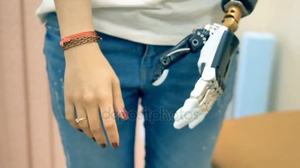 Gehandicapte vrouw toont haar bionic hand. 4k. — Stockvideo