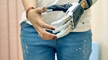 Modern tıp kavramı. Robot Protez kol bir Engelli kadın el şekline bağlı. 4k.