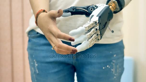 Pojem moderní medicíny. Robotické protézy rameno připojené k postižené ženě ruku. 4k. — Stock video