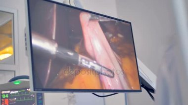 Yakın çekim cerrahi göstermek üstünde perde. Doktor ameliyat sırasında Robotik tıbbi cihazlar kullanılıyor. 4k.