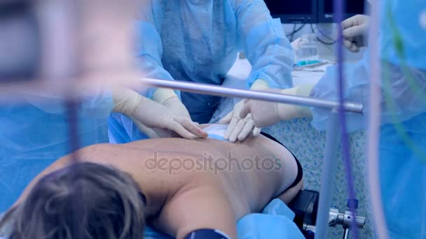 Doctor put bandage on a patients back after surgery. — Stock Video