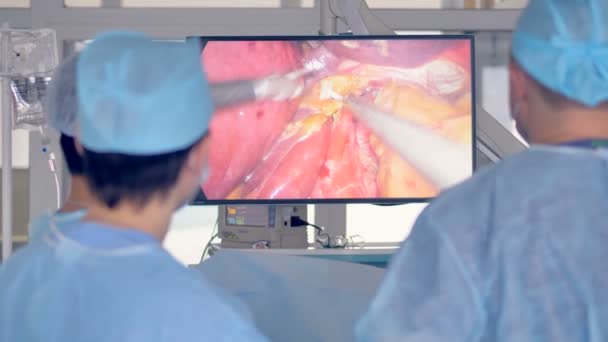 Médicos perfom cirugía utilizando equipo médico robótico. Monitor muestra procedimiento en segundo plano . — Vídeos de Stock