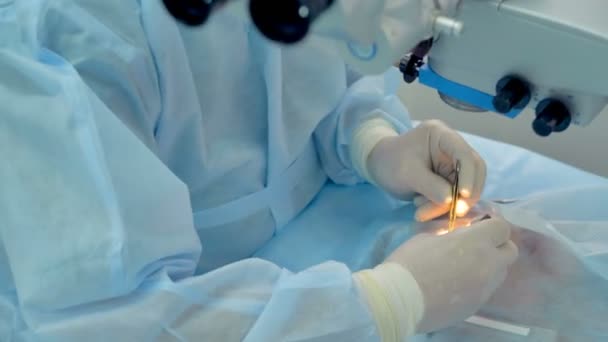 Tentu dokter bedah tangan bekerja selama operasi mata invasif . — Stok Video