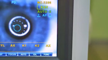 Retina kamera kontrol ekranı.