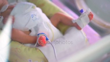 Cılız ve zayıf yenidoğan bacaklar yoğun bakım aygıta bağlı.