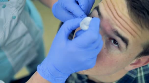 Um jovem recebe algum remédio caído em seus olhos por um óptico. 4K . — Vídeo de Stock