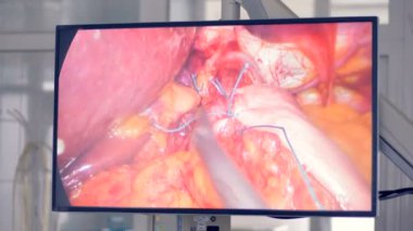 Ekran nasıl modern kliniğinde tıbbi robot cerrah kullandığını gösterir. Yenilikçi tıp kavramı.