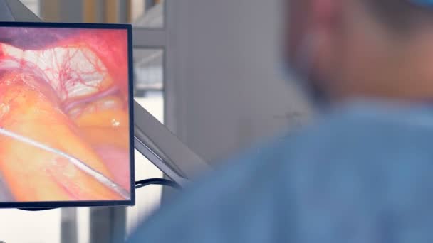 El cirujano usa un robot médico en la clínica moderna. Concepto de medicina innovadora . — Vídeos de Stock