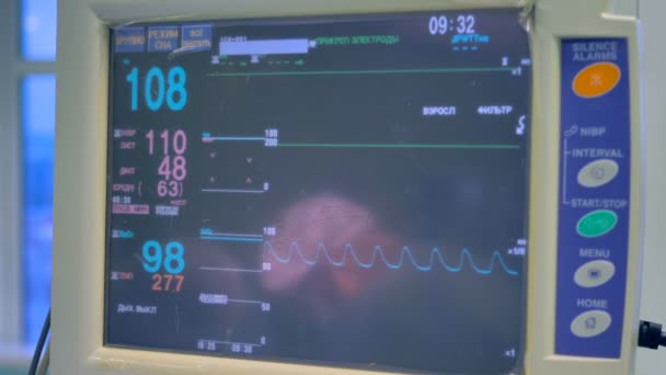 A screen with patients life signs during surgery. — Stock Video