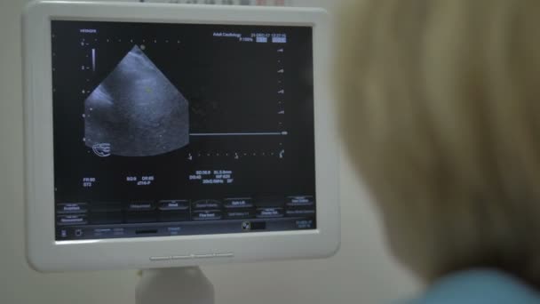Вид через плечо врача на ультразвуковой экран . — стоковое видео