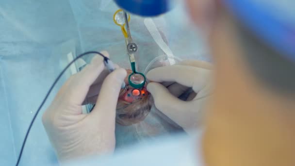 Médico mãos vestindo luvas cirúrgicas realizando cirurgia usando equipamentos esterilizados . — Vídeo de Stock
